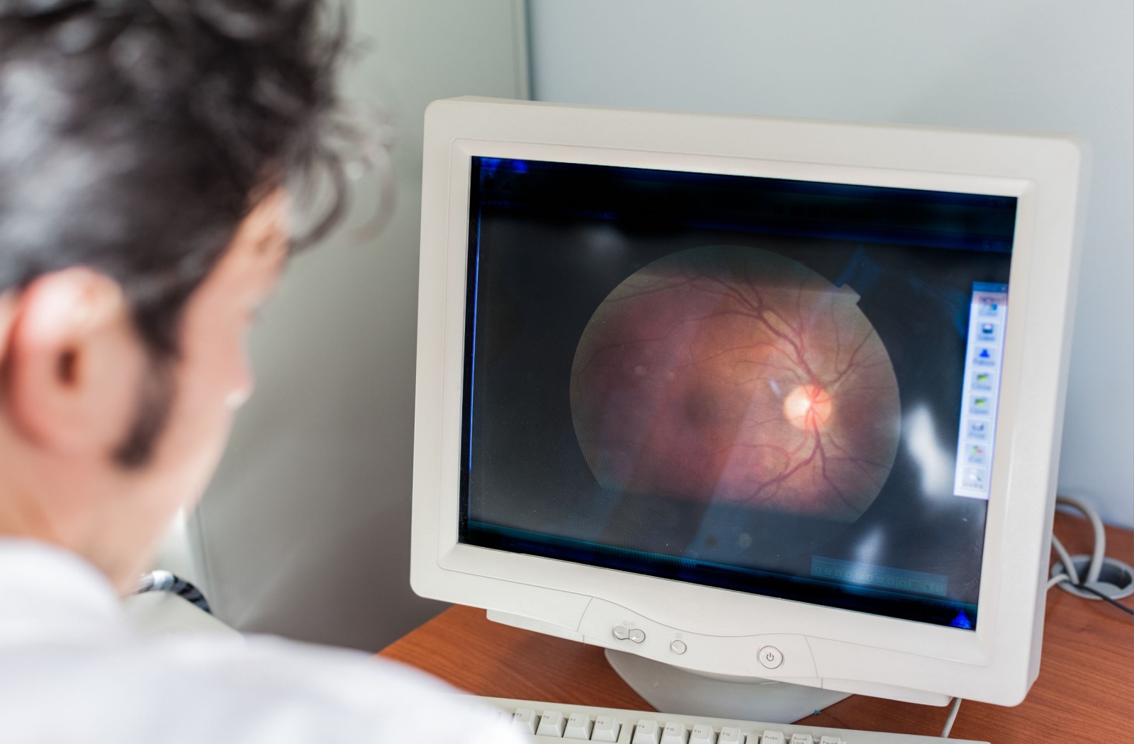 An optometrist looking at a retinal image on a computer screen.